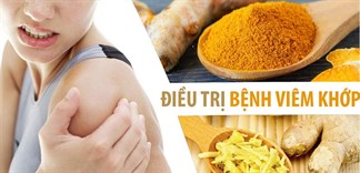 bột nghệ nguyên chất giúp giảm viêm 